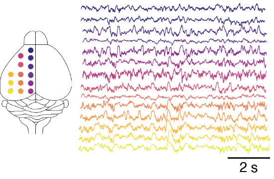 A manifold of heterogeneous brain states across cortical areas