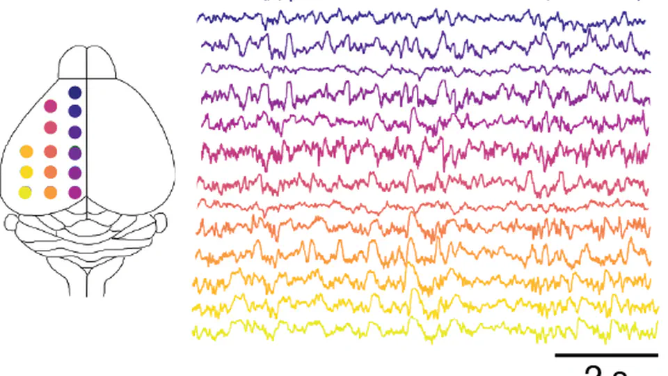 A manifold of heterogeneous brain states across cortical areas