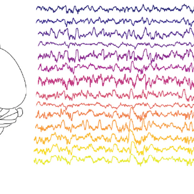 A manifold of heterogeneous brain states across cortical areas